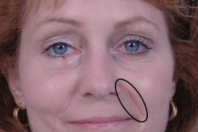 关于?頰?的信息